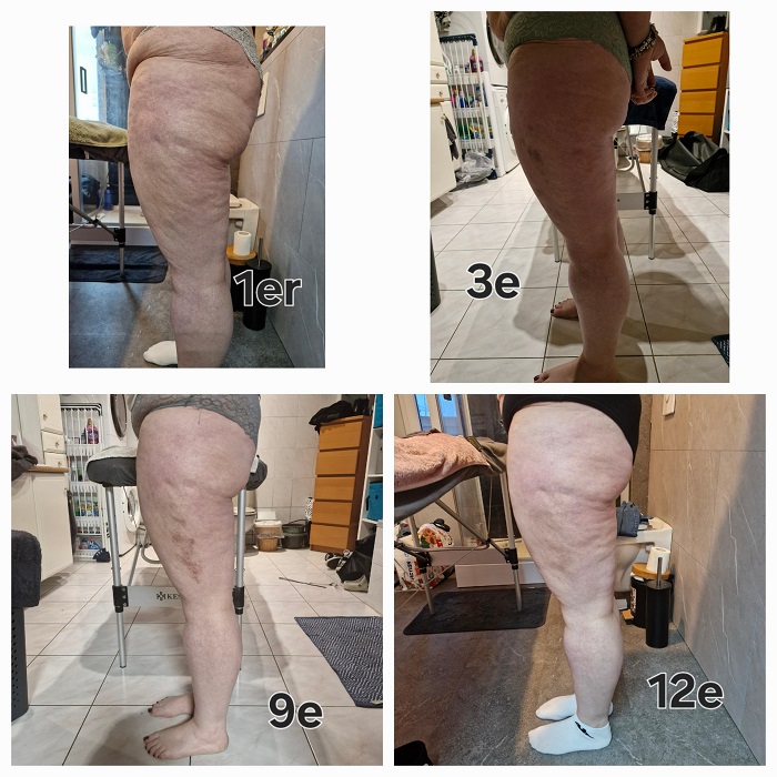 Madérothérapie - photo 1